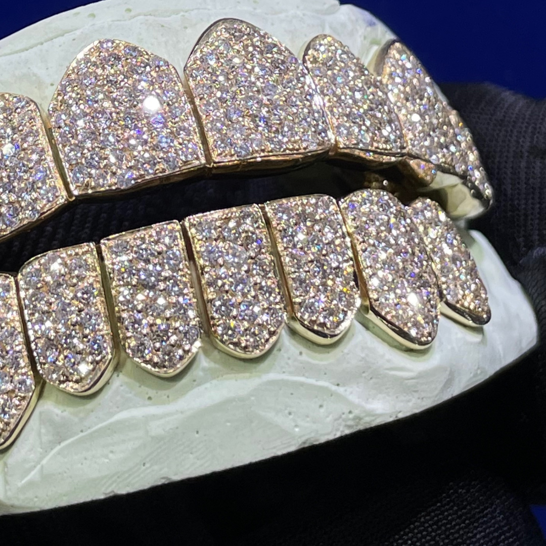Custom Diamond Teeth – Zevar Jewelers